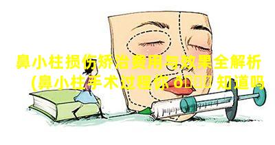 鼻小柱损伤矫治费用与效果全解析(鼻小柱手术过程你 🐅 知道吗(图))